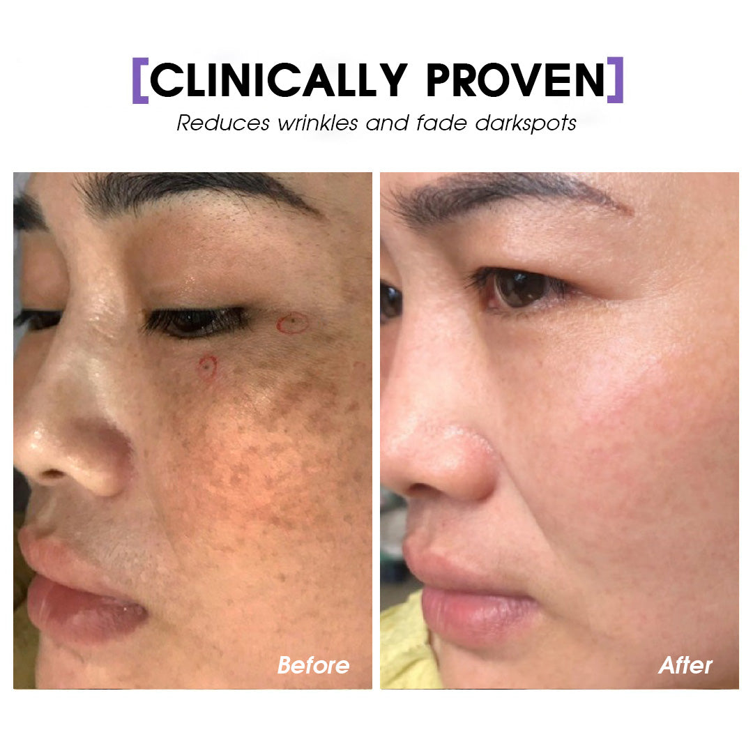 21 Days Skin Essence SEYOUL