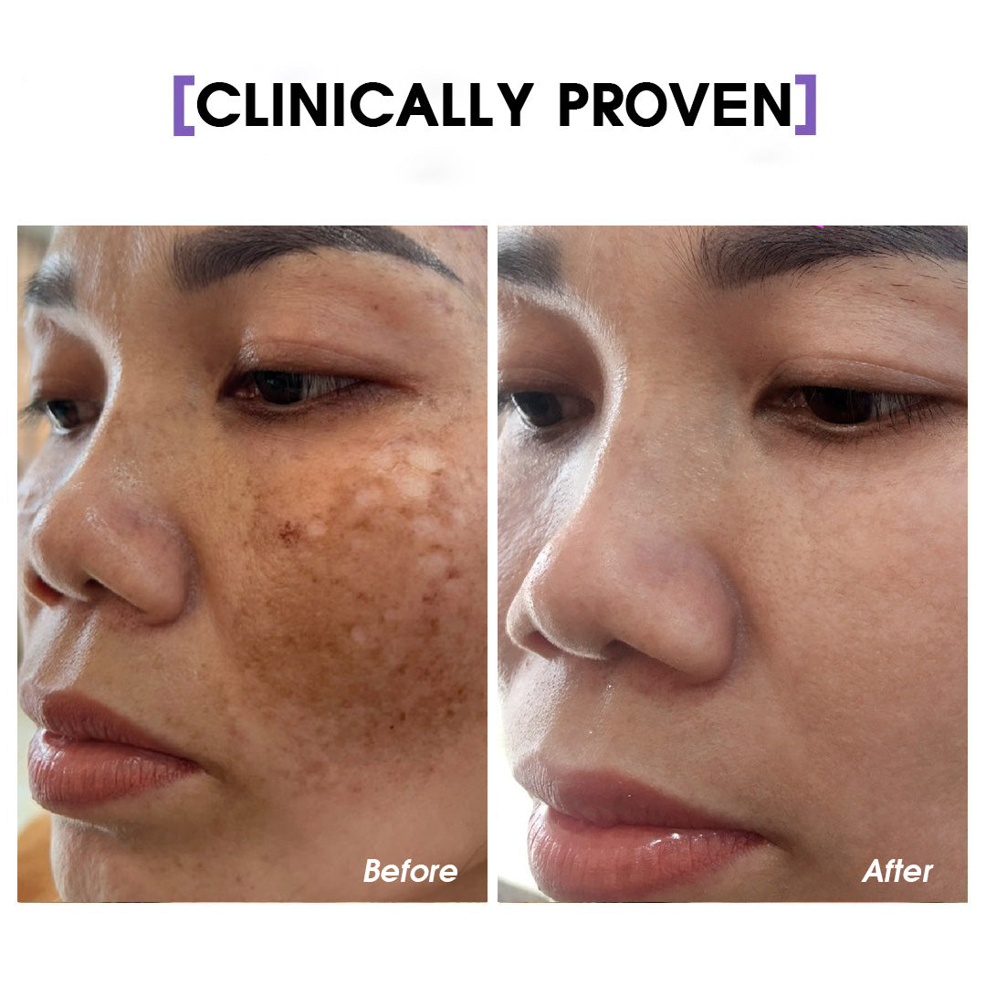 21 Days Skin Essence SEYOUL