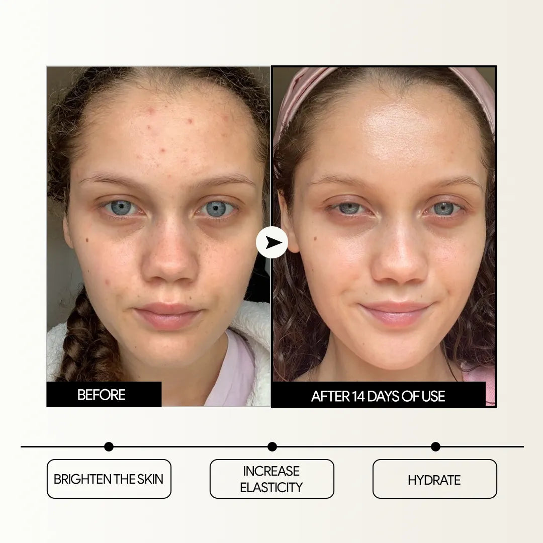 SOS Brightening Ampoule
