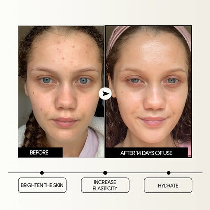 SOS Brightening Ampoule (v3)